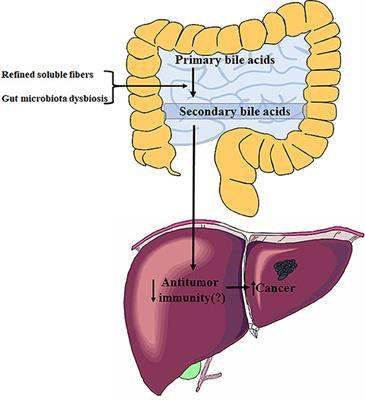 Commentary: Dysregulated Microbial Fermentation of Soluble Fiber Induces Cholestatic Liver Cancer